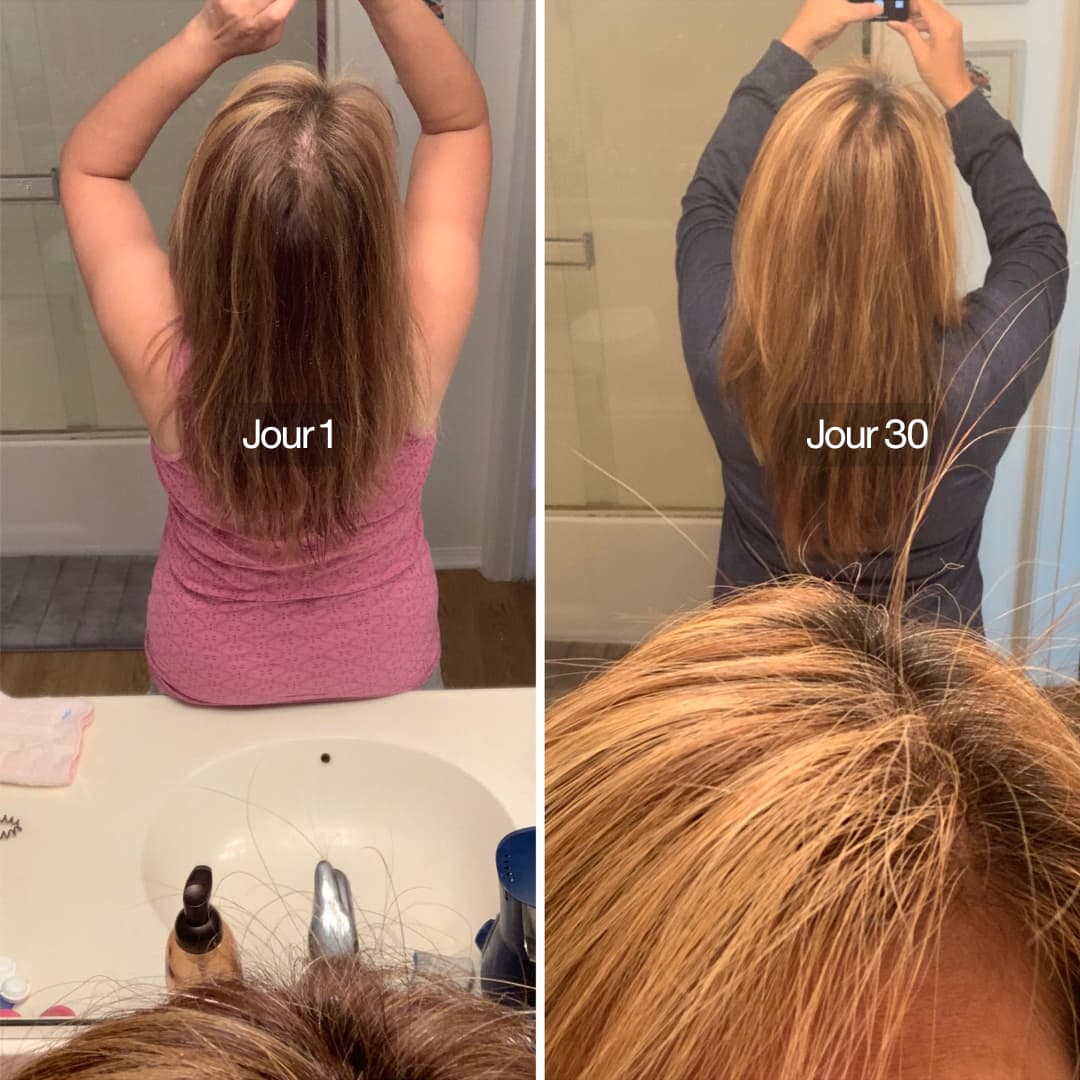 Pommeau de douche filtrant 3 en 1 Osen Pure™️