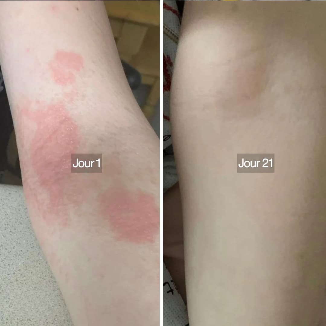 Pommeau de douche filtrant 3 en 1 Osen Pure™️