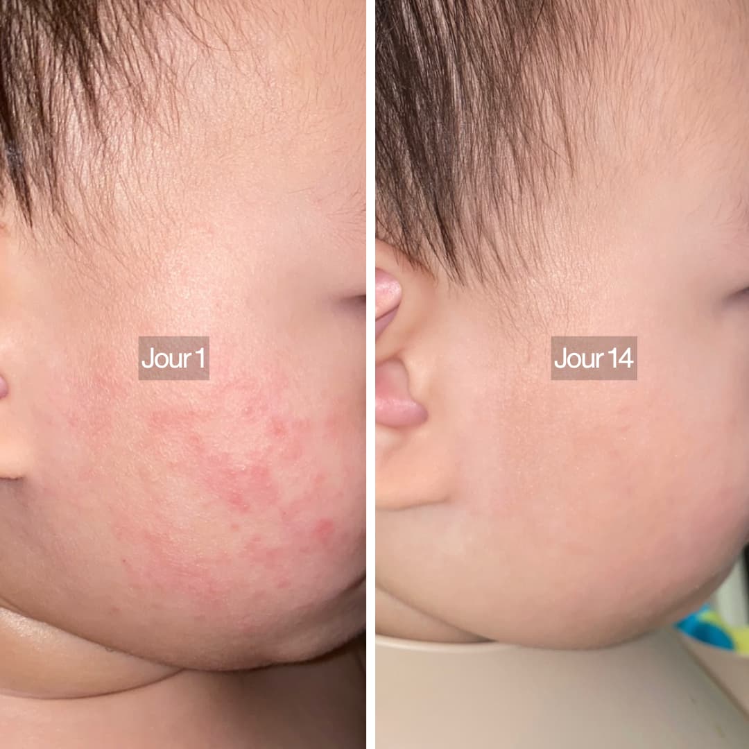 Pommeau de douche filtrant 3 en 1 Osen Pure™️