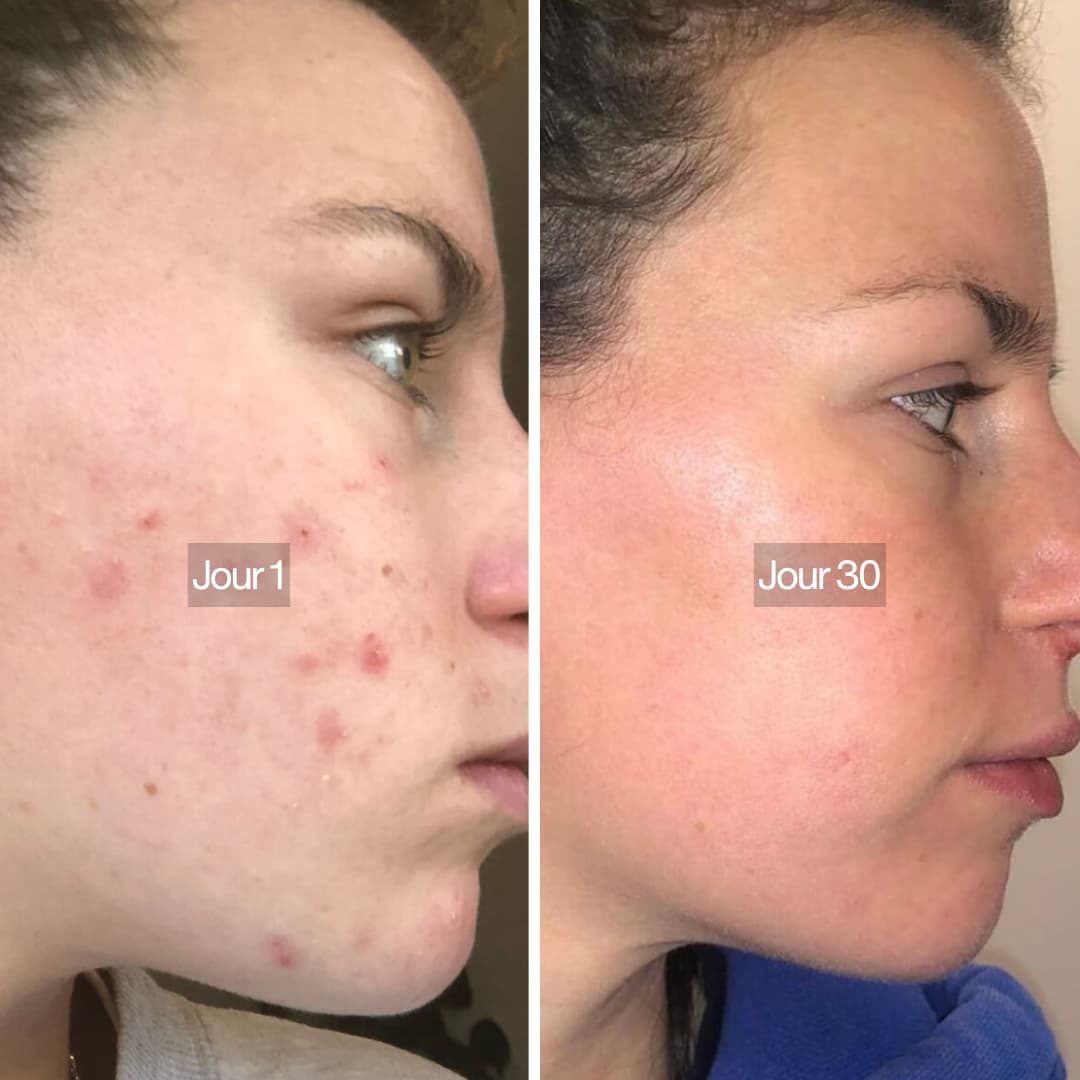 Pommeau de douche filtrant 3 en 1 Osen Pure™️